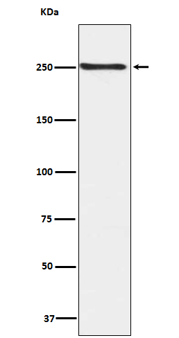 Phospho-mTOR (Ser2448) Rabbit mAb ABZ5264