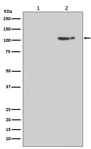 Phospho-Glutamate Receptor 1 (AMPA Subtype) (Ser845) Rabbit mAb ABZ5265
