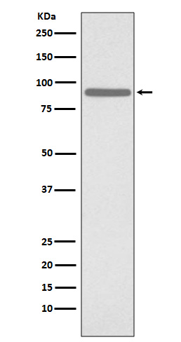 Phospho-STAT1 (Ser727) Rabbit mAb ABZ5266