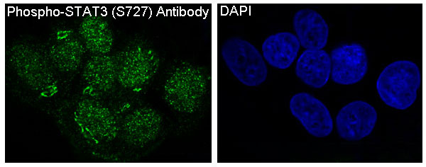 Phospho-STAT3 (Ser727) Rabbit mAb ABZ5267