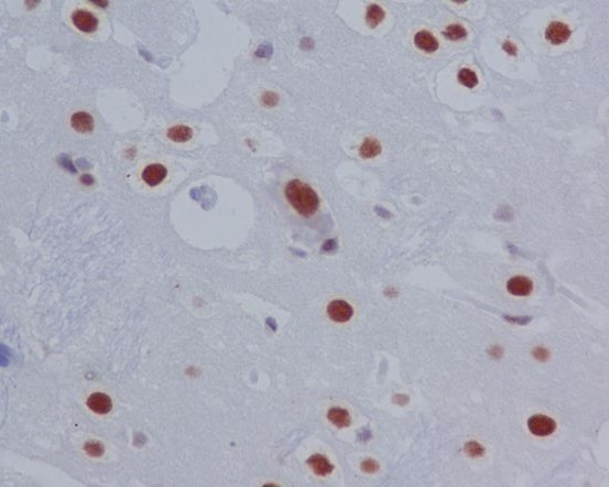 Phospho-STAT3 (Ser727) Rabbit mAb ABZ5267