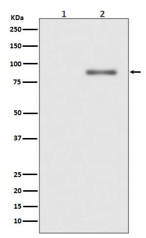 Phospho-PKC alpha (Thr638) Rabbit mAb ABZ5268