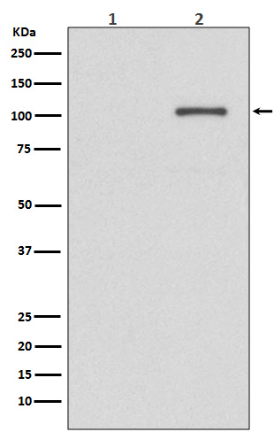 Phospho-IRE1 (Ser724) Rabbit mAb ABZ5270