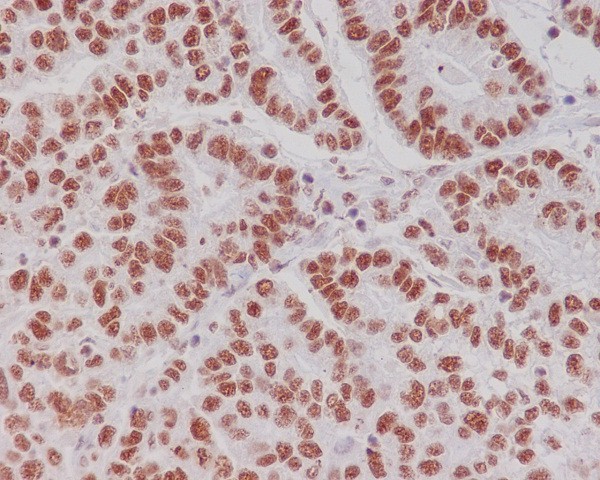 Phospho-CREB (Ser133) Rabbit mAb ABZ5271