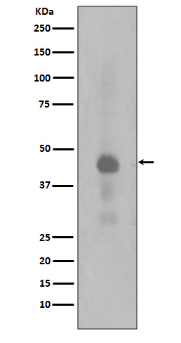 Phospho-CREB (Ser133) Rabbit mAb ABZ5271