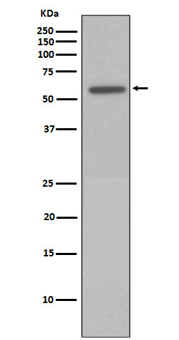 Phospho-Vimentin (Ser72) Rabbit mAb ABZ5272