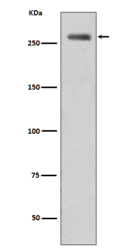Phospho-LRRK2 (Ser395) Rabbit mAb ABZ5273