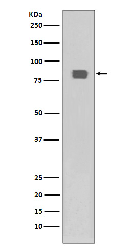Phospho-HSF1 (Ser326) Rabbit mAb ABZ5274