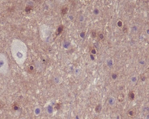 Phospho-PAK1/2/3 (Ser144/Ser141/Ser154) Rabbit mAb ABZ5276
