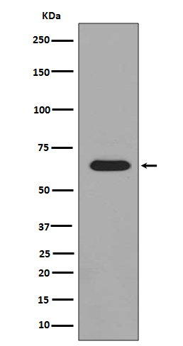 Phospho-PAK1/2/3 (Ser144/Ser141/Ser154) Rabbit mAb ABZ5276