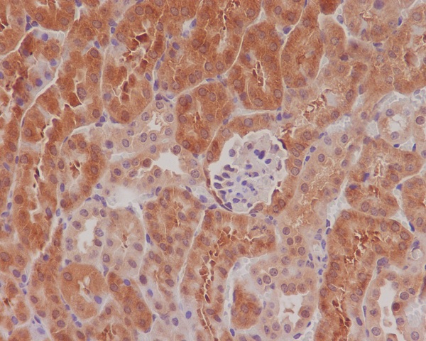 Phospho-eIF4E (Ser209) Rabbit mAb ABZ5278