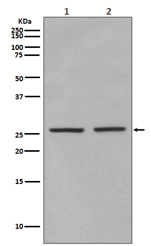 Phospho-eIF4E (Ser209) Rabbit mAb ABZ5278