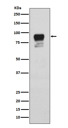 Phospho-Glycogen synthase 1/GYS1(Ser641) Rabbit mAb ABZ5279