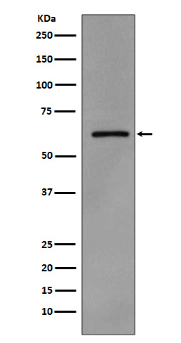 Phospho-Src (Tyr419) Rabbit mAb ABZ5280