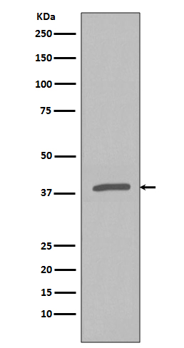 Phospho-IKB alpha (Ser32) Rabbit mAb ABZ5282