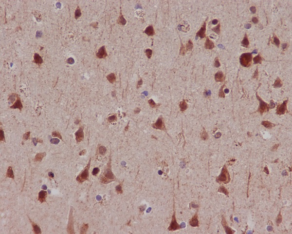 Phospho-MSK1 (Ser376) Rabbit mAb ABZ5285