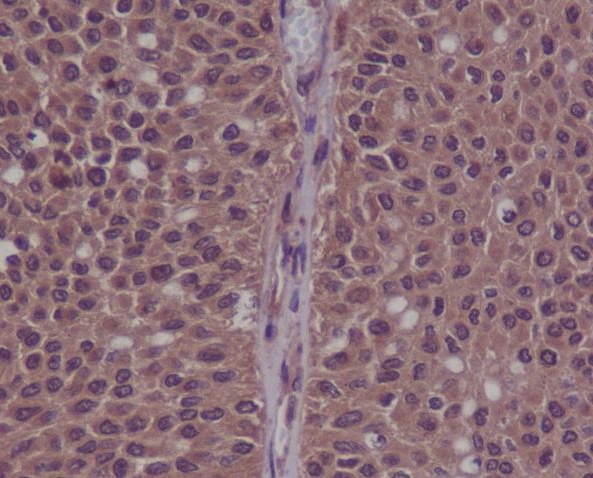 Phospho-CDK2 (Tyr15) Rabbit mAb ABZ5286