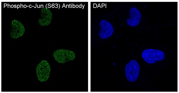 Phospho-c-Jun (Ser63) Rabbit mAb ABZ5290