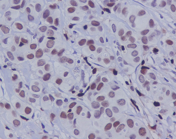 Phospho-c-Jun (Ser63) Rabbit mAb ABZ5290