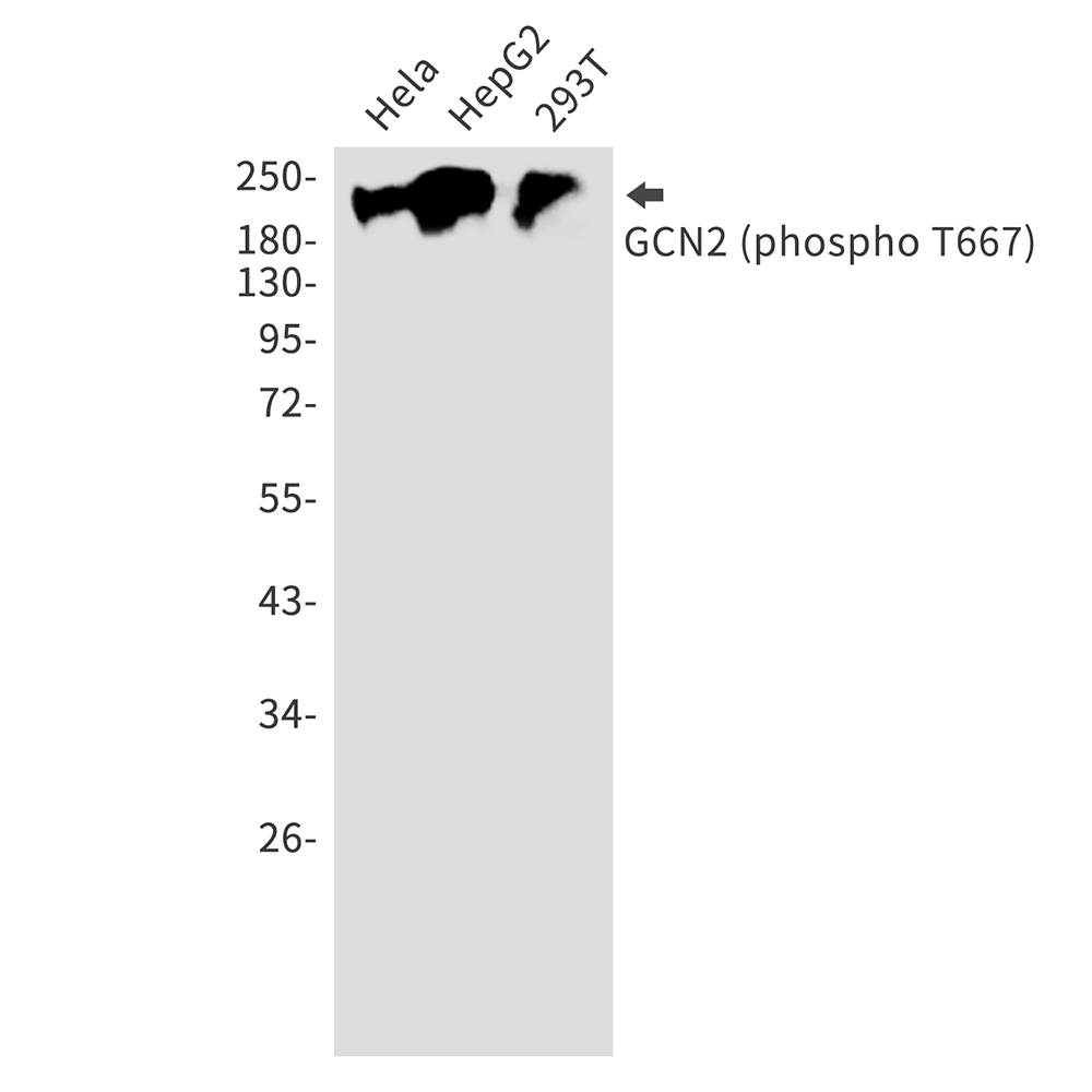 Phospho-GCN2 (Thr667) Rabbit mAb ABZ5295