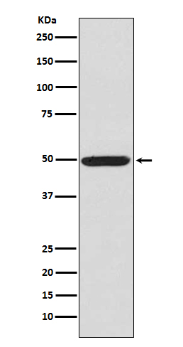 Phospho-PRKAR2A (Ser99) Rabbit mAb ABZ5296