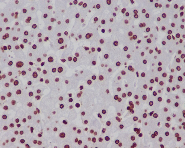 MonoMethyl-Histone H3 (Lys18) Rabbit mAb ABZ5301