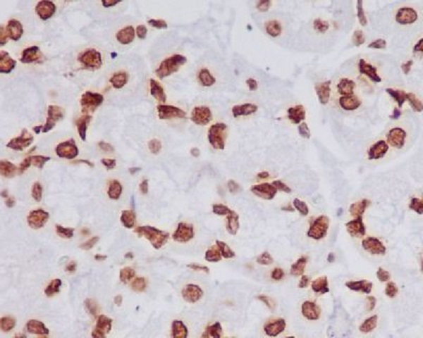 TriMethyl-Histone H4 (Lys20) Rabbit mAb ABZ5303