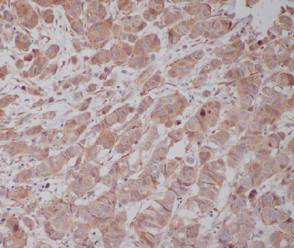 gamma Tubulin Rabbit mAb ABZ5304