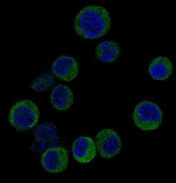 [KD]IRF3 Rabbit mAb ABZ5306