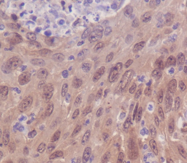 [KD]IRF3 Rabbit mAb ABZ5306