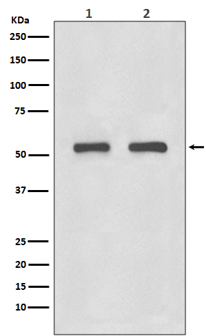 [KD]IRF3 Rabbit mAb ABZ5306