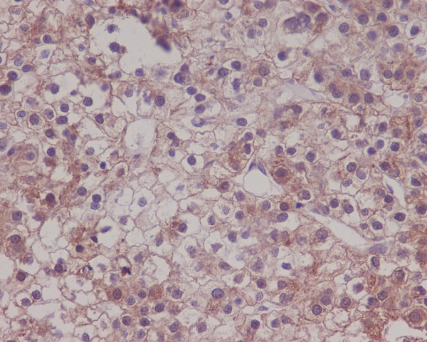 [KD]LRP1 Rabbit mAb ABZ5307