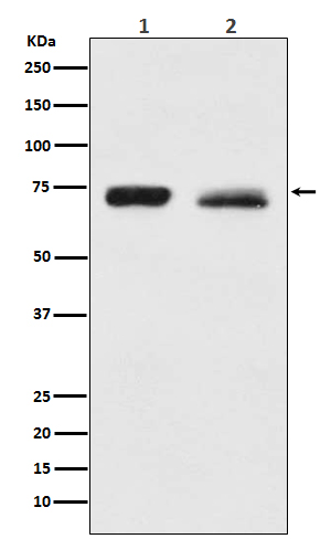[KO]NF2/Merlin Rabbit mAb ABZ5309