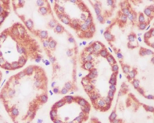 [KD]Prohibitin Rabbit mAb ABZ5310