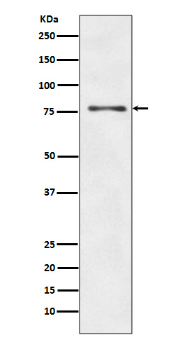 [KO]ATG7 Rabbit mAb ABZ5312
