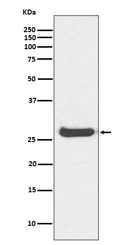 [KO]Histone H1 Rabbit mAb ABZ5317