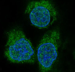 [KD]4E BP1 Rabbit mAb ABZ5319