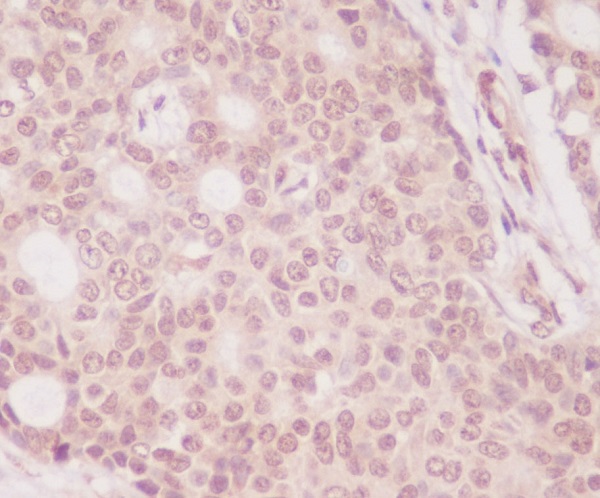 [KD]4E BP1 Rabbit mAb ABZ5319