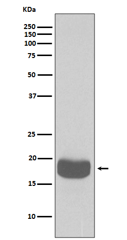 [KD]4E BP1 Rabbit mAb ABZ5319
