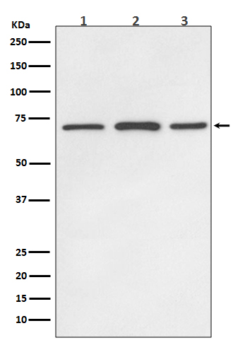 [KD]SDHA Rabbit mAb ABZ5320