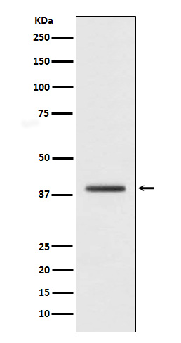 [KD]mH2A1 Rabbit mAb ABZ5322