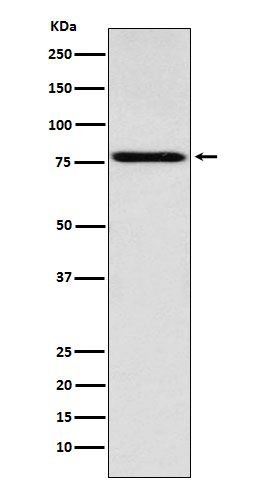 [KD]Coilin Rabbit mAb ABZ5325