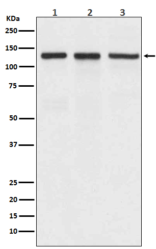 [KD]Integrin alpha V Rabbit mAb ABZ5326