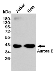 [KD]Aurora B Rabbit mAb ABZ5327