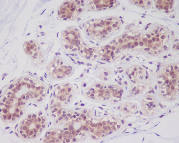 [KD]Cortactin Rabbit mAb ABZ5328