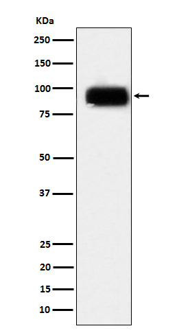 [KO]CD166 Rabbit mAb ABZ5329