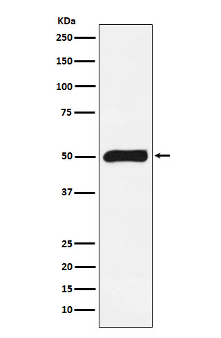 [KO]FKBP51 Rabbit mAb ABZ5330