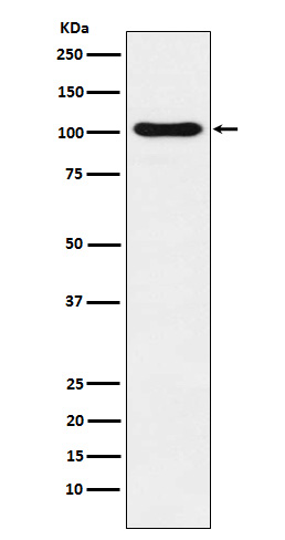 [KO]DNA Ligase IV Rabbit mAb ABZ5333