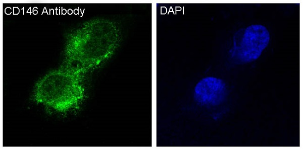 [KD]CD146 Rabbit mAb ABZ5334