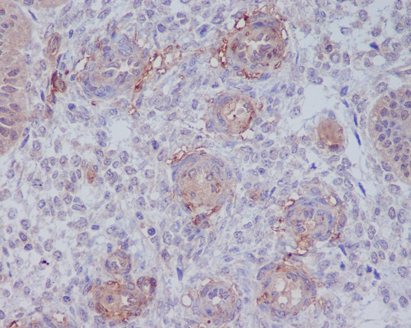 [KD]CD146 Rabbit mAb ABZ5334